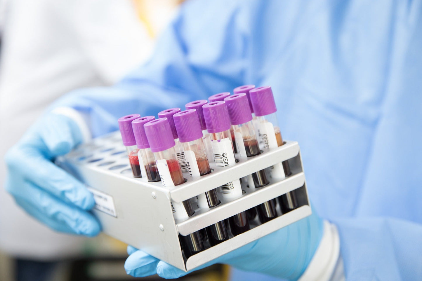 IMULAB Ferritin Blood Test – check iron storage levels with fast, doctor-reviewed UK lab results.